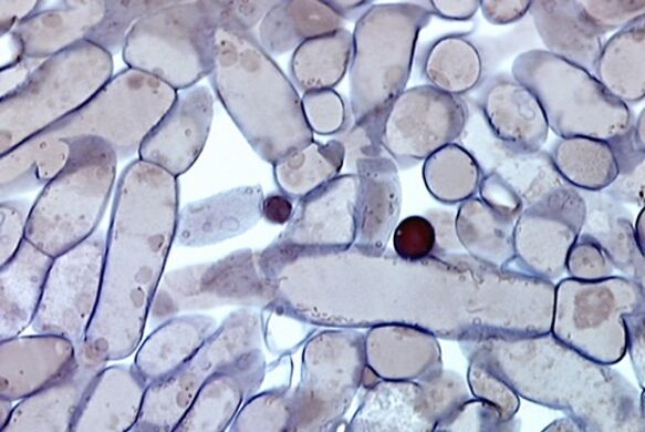 buňky nehtové houby pod mikroskopem