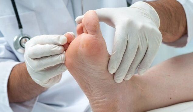 léčba a diagnostika plísní lékařem