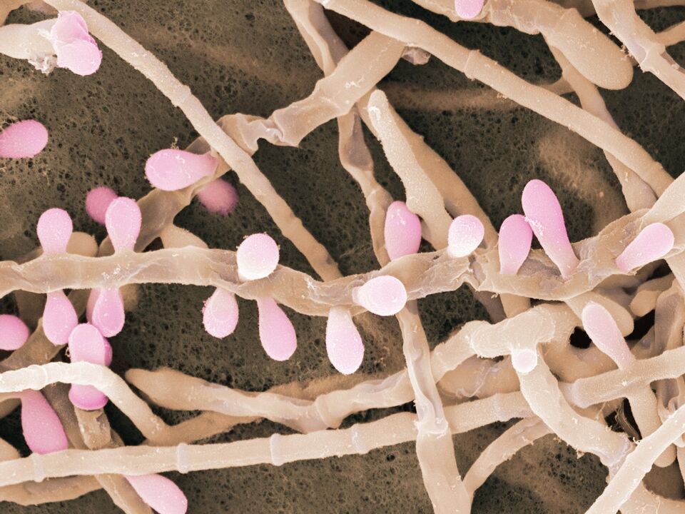 Trichophyton rubrum je druh plísně, která postihuje kůži nohou.
